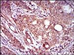 Dynactin 4 Antibody in Immunohistochemistry (Paraffin) (IHC (P))