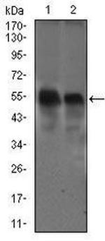 Dynactin 4 Antibody in Western Blot (WB)