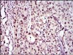 PCNA Antibody in Immunohistochemistry (Paraffin) (IHC (P))