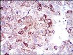 SLC27A5 Antibody in Immunohistochemistry (Paraffin) (IHC (P))