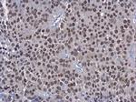 HNF1A Antibody in Immunocytochemistry (ICC/IF)