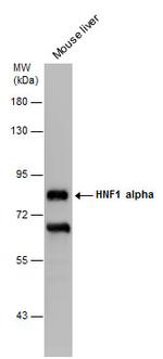 HNF1A Antibody in Western Blot (WB)