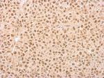 IP6K1 Antibody in Immunohistochemistry (Paraffin) (IHC (P))