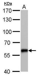 CBS Antibody in Western Blot (WB)