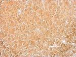 Cofilin Antibody in Immunohistochemistry (Paraffin) (IHC (P))