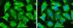 TAGLN Antibody in Immunocytochemistry (ICC/IF)