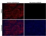 TAGLN Antibody in Immunohistochemistry (Paraffin) (IHC (P))