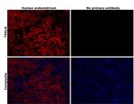 TAGLN Antibody in Immunohistochemistry (Paraffin) (IHC (P))