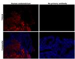 TAGLN Antibody in Immunohistochemistry (Paraffin) (IHC (P))