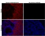 TAGLN Antibody in Immunohistochemistry (Paraffin) (IHC (P))