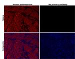 TAGLN Antibody in Immunohistochemistry (Paraffin) (IHC (P))