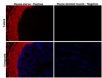 TAGLN Antibody in Immunohistochemistry (Paraffin) (IHC (P))