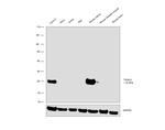 TAGLN Antibody in Western Blot (WB)