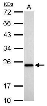 TAGLN Antibody in Western Blot (WB)