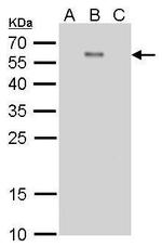 Dengue Virus Type 2 Envelope Antibody in Western Blot (WB)