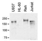 MERTK Antibody in Western Blot (WB)