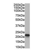 CYBA Antibody in Western Blot (WB)