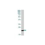 Cathelicidin Antibody in Western Blot (WB)