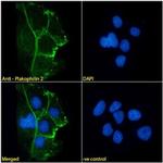 PKP2 Antibody in Immunocytochemistry (ICC/IF)