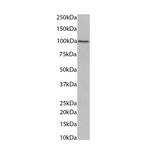 PKP2 Antibody in Western Blot (WB)