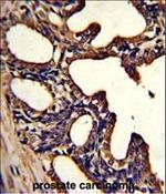 Lactoferrin Antibody in Immunohistochemistry (Paraffin) (IHC (P))