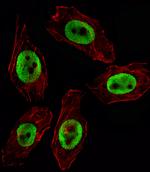 EZH2 Antibody in Immunocytochemistry (ICC/IF)