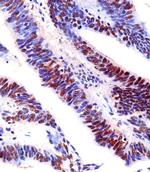 EZH2 Antibody in Immunohistochemistry (Paraffin) (IHC (P))