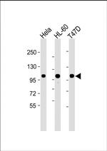 EZH2 Antibody in Western Blot (WB)