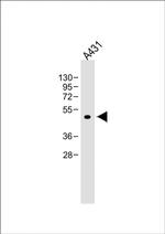 ATG4D Antibody in Western Blot (WB)