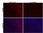 CD45RB Antibody in Immunohistochemistry (Paraffin) (IHC (P))