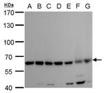 COPD Antibody in Western Blot (WB)