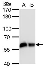 COPD Antibody in Western Blot (WB)