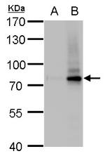 SLU7 Antibody in Western Blot (WB)