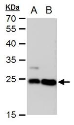 LIN7A Antibody in Western Blot (WB)