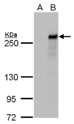 TET2 Antibody in Western Blot (WB)