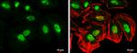 CAS Antibody in Immunocytochemistry (ICC/IF)