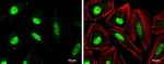 CAS Antibody in Immunocytochemistry (ICC/IF)