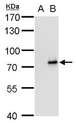 SLU7 Antibody in Western Blot (WB)