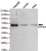 GTF2H1 Antibody in Western Blot (WB)