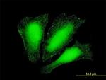 ATOX1 Antibody in Immunocytochemistry (ICC/IF)