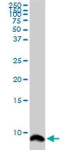 ATOX1 Antibody in Western Blot (WB)