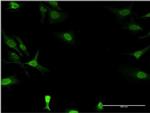 DCK Antibody in Immunocytochemistry (ICC/IF)