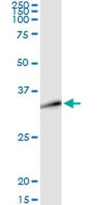 DLX1 Antibody in Immunoprecipitation (IP)