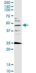 FOXF2 Antibody in Western Blot (WB)