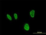 HOXA5 Antibody in Immunocytochemistry (ICC/IF)