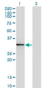 HOXA1/HOXB1/HOXD1 Antibody in Western Blot (WB)