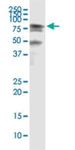 HSPA2 Antibody in Immunoprecipitation (IP)