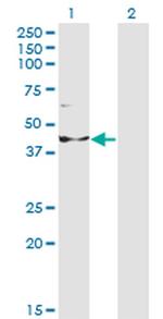 INPP1 Antibody in Western Blot (WB)