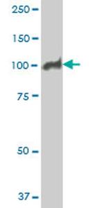 MCM3 Antibody in Western Blot (WB)