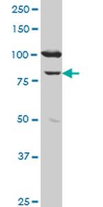 MCM3 Antibody in Western Blot (WB)